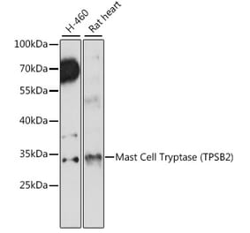 Western Blot - Anti-TPSB2 Antibody (A89171) - Antibodies.com