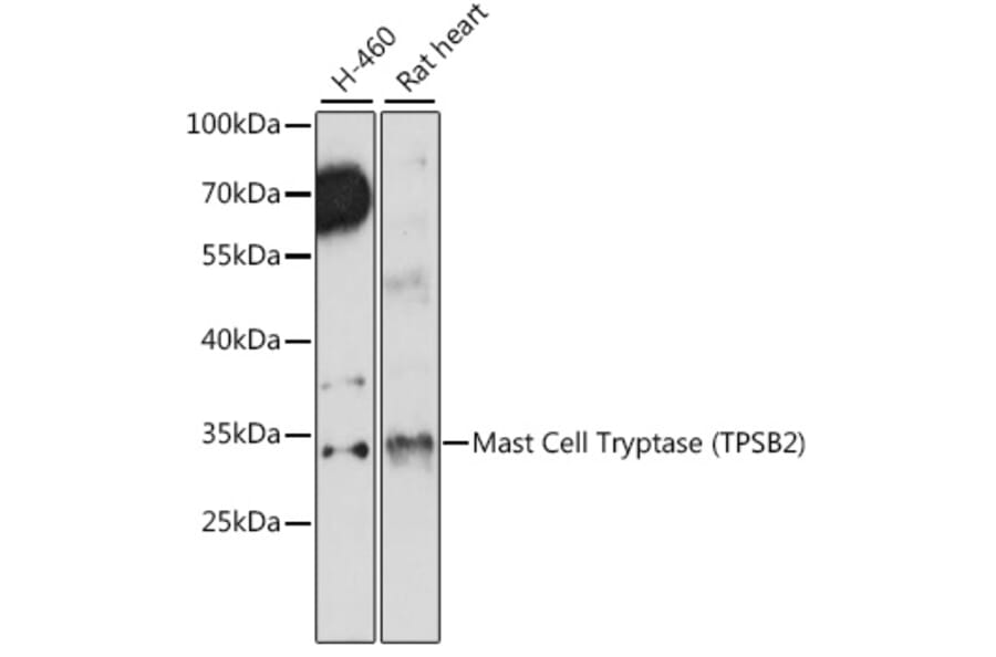 Western Blot - Anti-TPSB2 Antibody (A89171) - Antibodies.com
