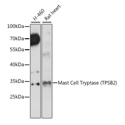 Western Blot - Anti-TPSB2 Antibody (A89171) - Antibodies.com