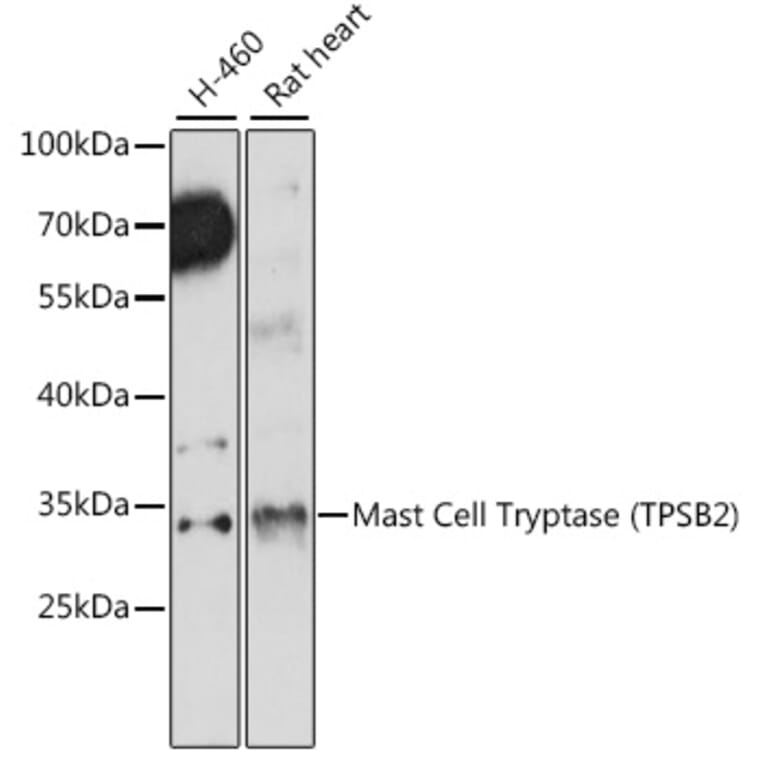 Western Blot - Anti-TPSB2 Antibody (A89171) - Antibodies.com