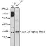 Western Blot - Anti-TPSB2 Antibody (A89171) - Antibodies.com