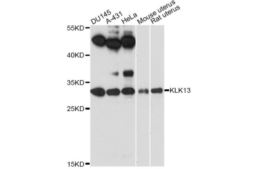 Western Blot - Anti-KLK13 Antibody (A14274) - Antibodies.com