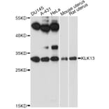 Western Blot - Anti-KLK13 Antibody (A14274) - Antibodies.com