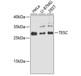 Western Blot - Anti-TESC Antibody (A89173) - Antibodies.com