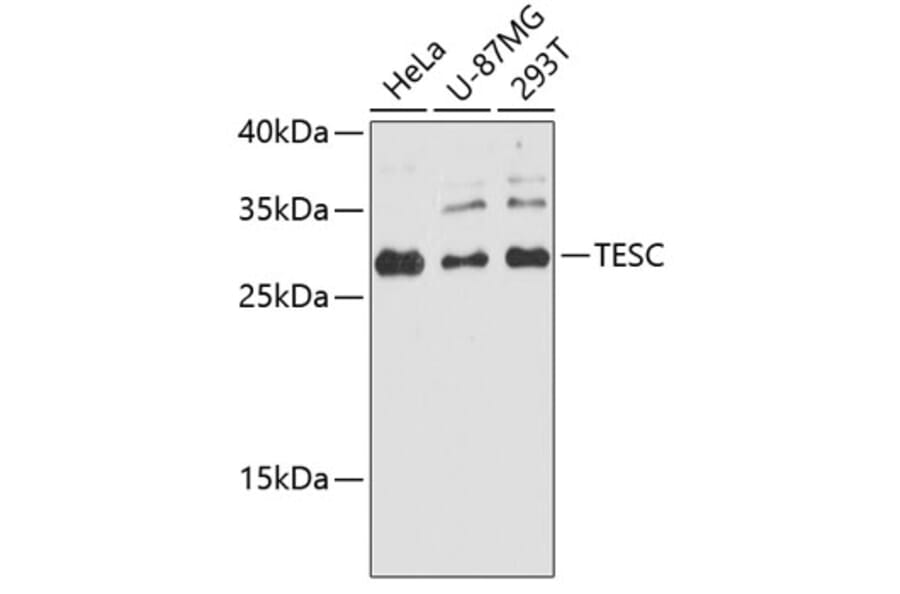Western Blot - Anti-TESC Antibody (A89173) - Antibodies.com