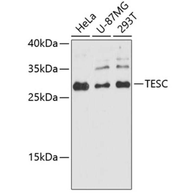 Western Blot - Anti-TESC Antibody (A89173) - Antibodies.com