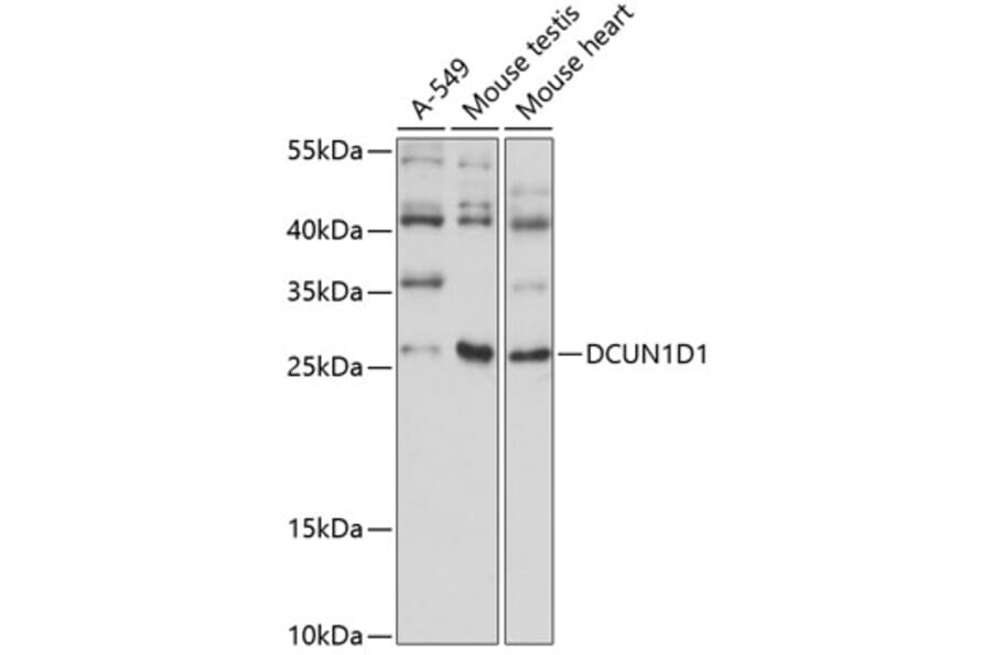 Western Blot - Anti-DCUN1D1 Antibody (A89174) - Antibodies.com