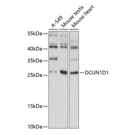 Western Blot - Anti-DCUN1D1 Antibody (A89174) - Antibodies.com