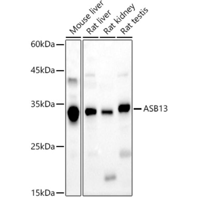 Western Blot - Anti-ASB13 Antibody (A89175) - Antibodies.com