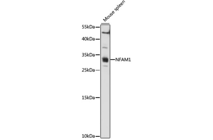 Western Blot - Anti-NFAM1 Antibody (A89176) - Antibodies.com