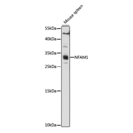 Western Blot - Anti-NFAM1 Antibody (A89176) - Antibodies.com