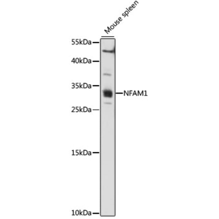 Western Blot - Anti-NFAM1 Antibody (A89176) - Antibodies.com
