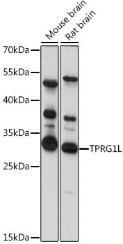 Western blot analysis of extracts of various cell lines, using Anti-TPRG1L Antibody (A15949) at 1:1,000 dilution.
Secondary antibody: Goat Anti-Rabbit IgG (H+L) (HRP) (AS014) at 1:10,000 dilution.
Lysates / proteins: 25µg per lane.
Blocking buffer: 3% non-fat dry milk in TBST.
Detection: ECL Basic Kit (RM00020).
Exposure time: 20s.