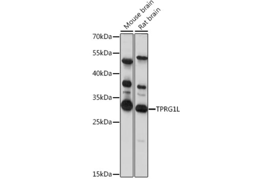 Western Blot - Anti-TPRG1L Antibody (A89177) - Antibodies.com