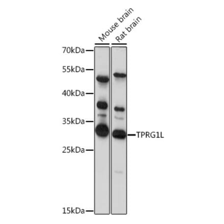 Western Blot - Anti-TPRG1L Antibody (A89177) - Antibodies.com