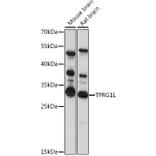 Western Blot - Anti-TPRG1L Antibody (A89177) - Antibodies.com