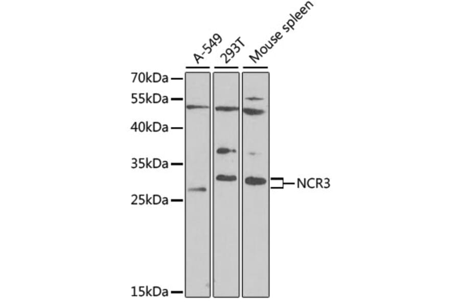 Western Blot - Anti-NCR3 Antibody (A12616) - Antibodies.com