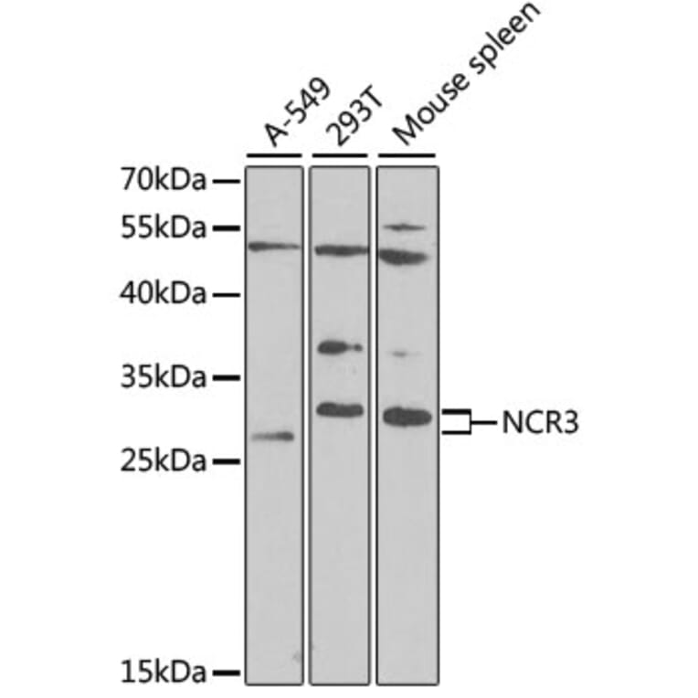 Western Blot - Anti-NCR3 Antibody (A12616) - Antibodies.com