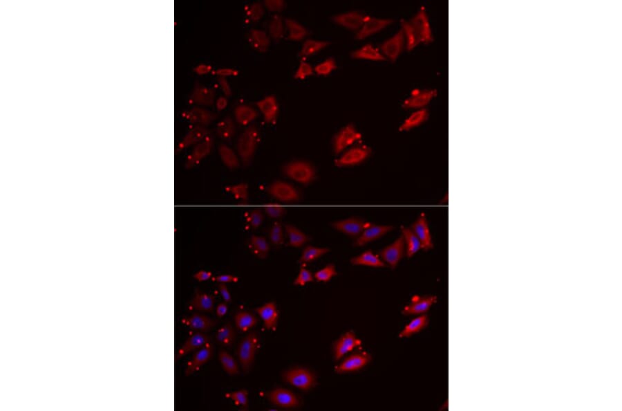 Immunofluorescence - Anti-NCR3 Antibody (A12616) - Antibodies.com