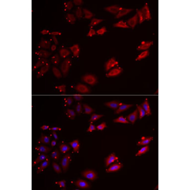 Immunofluorescence - Anti-NCR3 Antibody (A12616) - Antibodies.com
