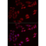 Immunofluorescence - Anti-NCR3 Antibody (A12616) - Antibodies.com