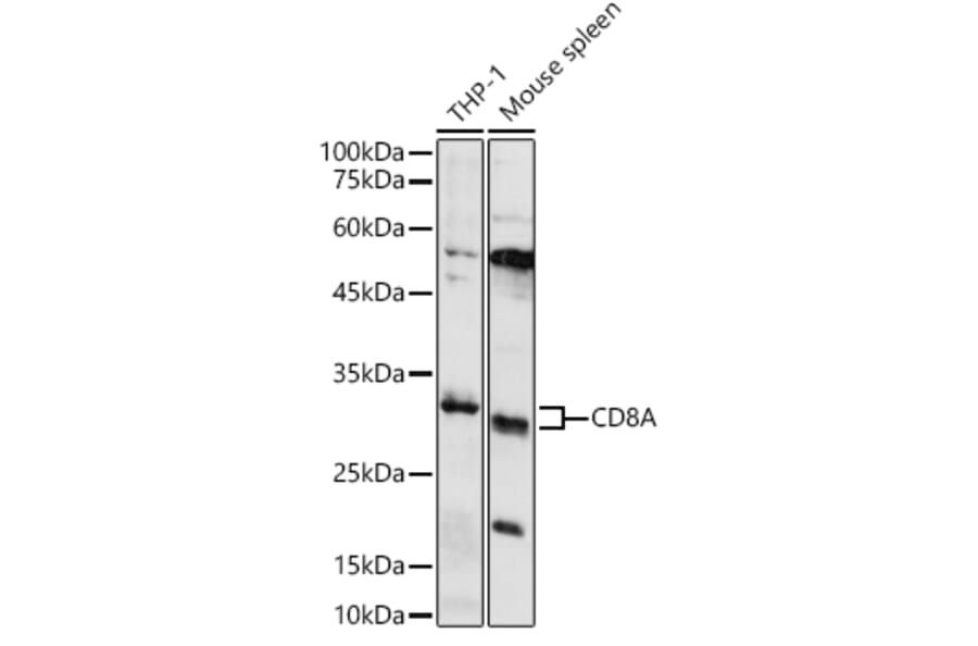 Western Blot - Anti-CD8 alpha Antibody (A89179) - Antibodies.com