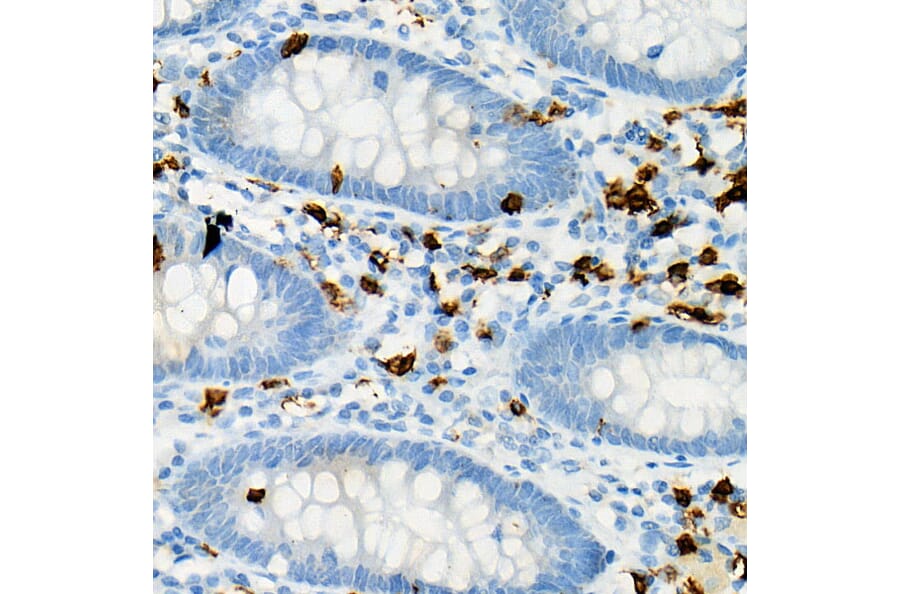 Immunohistochemistry - Anti-CD8 alpha Antibody (A89179) - Antibodies.com