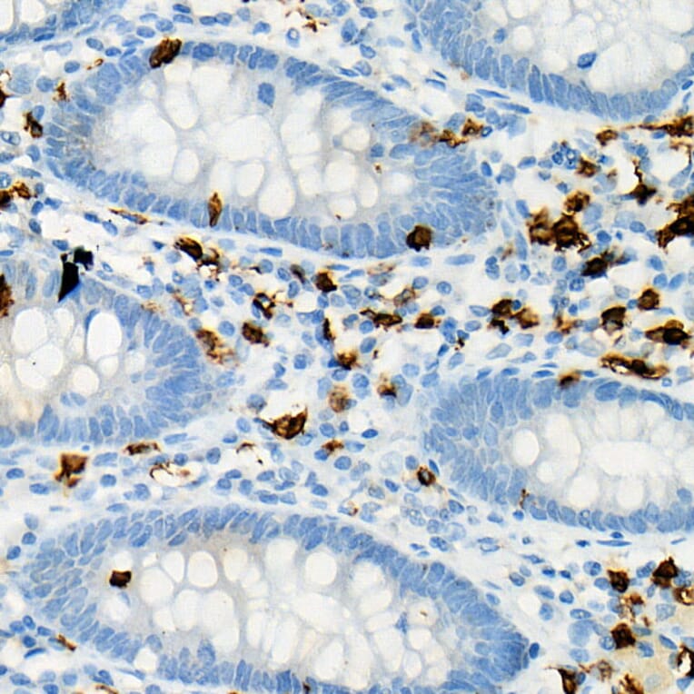 Immunohistochemistry - Anti-CD8 alpha Antibody (A89179) - Antibodies.com