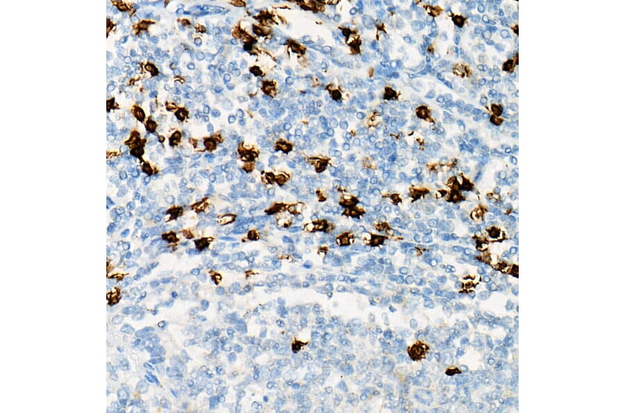 Immunohistochemistry - Anti-CD8 alpha Antibody (A89179) - Antibodies.com