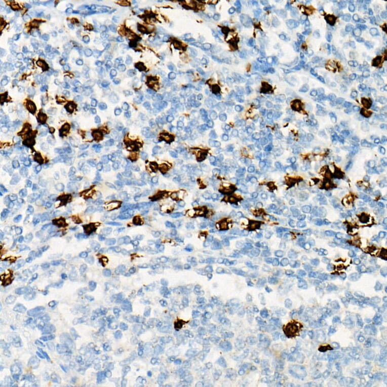 Immunohistochemistry - Anti-CD8 alpha Antibody (A89179) - Antibodies.com