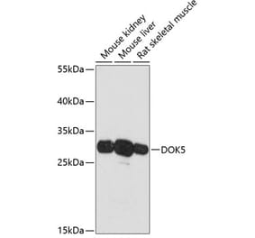 Western Blot - Anti-DOK5 Antibody (A89180) - Antibodies.com