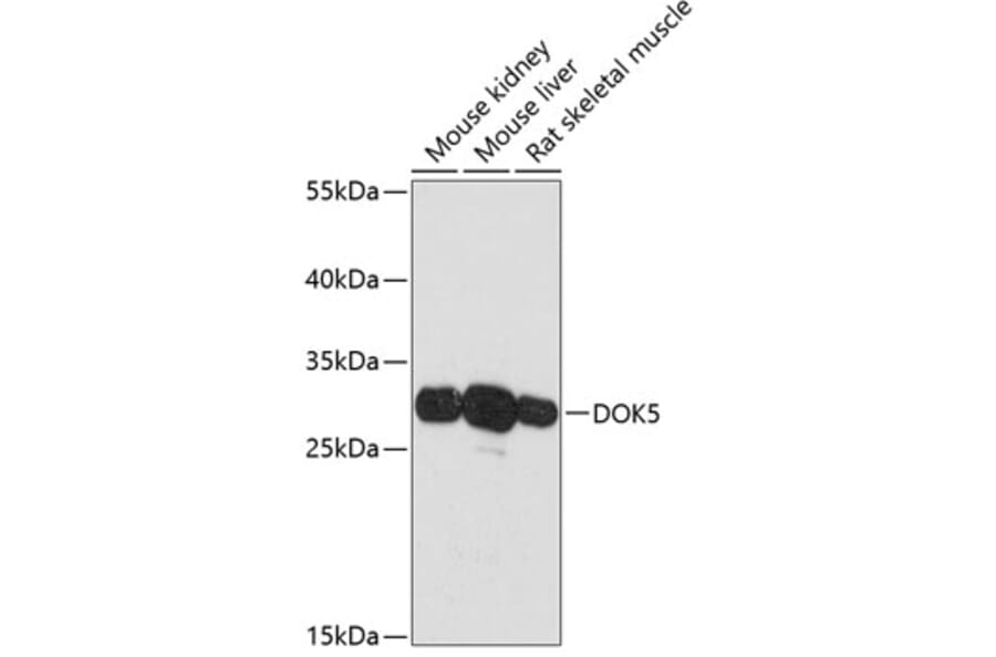 Western Blot - Anti-DOK5 Antibody (A89180) - Antibodies.com