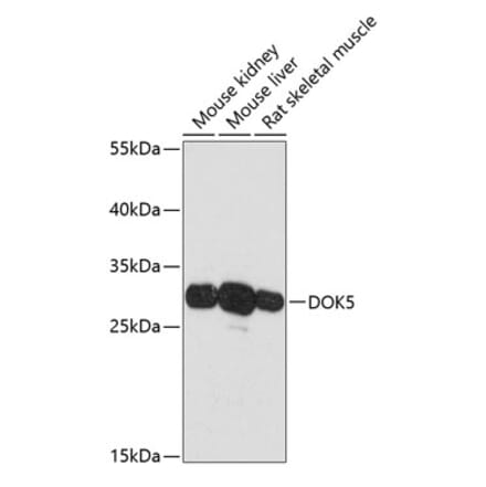 Western Blot - Anti-DOK5 Antibody (A89180) - Antibodies.com