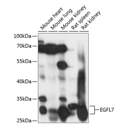 Western Blot - Anti-EGFL7 Antibody (A89181) - Antibodies.com