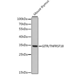 Western Blot - Anti-GITR Antibody (A89182) - Antibodies.com
