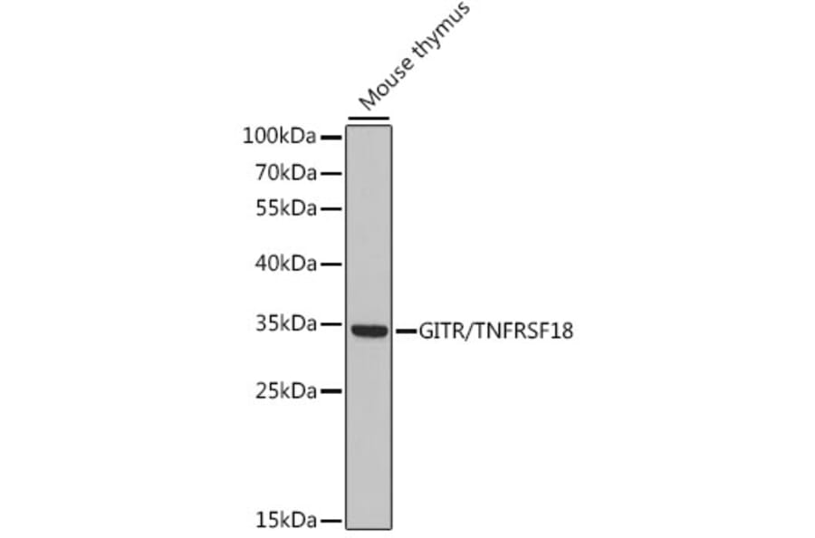Western Blot - Anti-GITR Antibody (A89182) - Antibodies.com