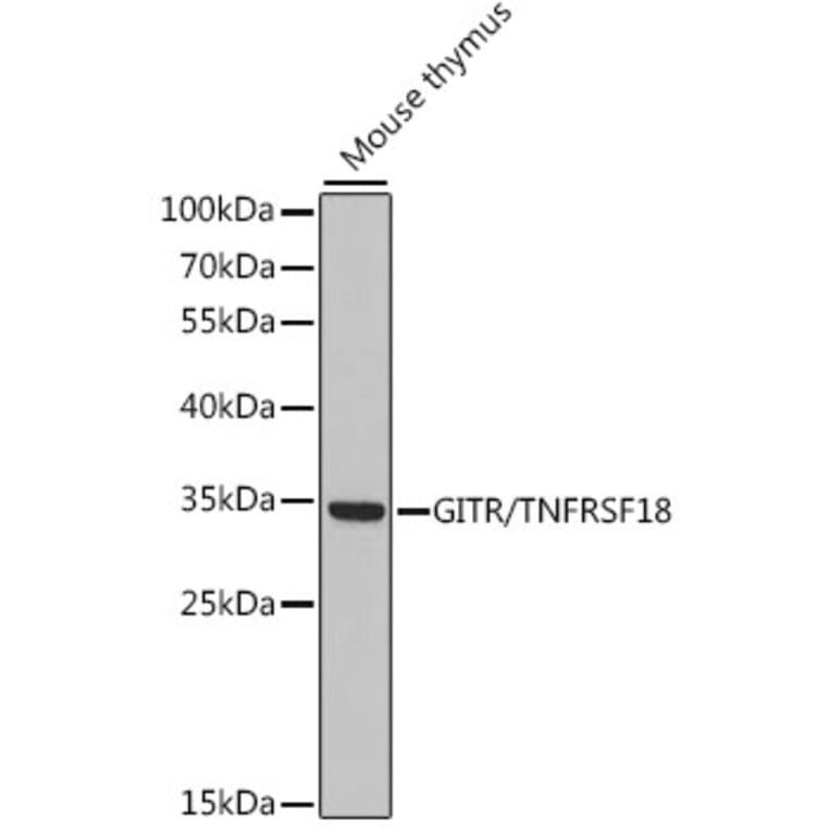 Western Blot - Anti-GITR Antibody (A89182) - Antibodies.com