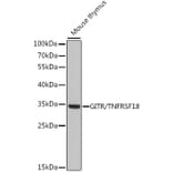 Western Blot - Anti-GITR Antibody (A89182) - Antibodies.com