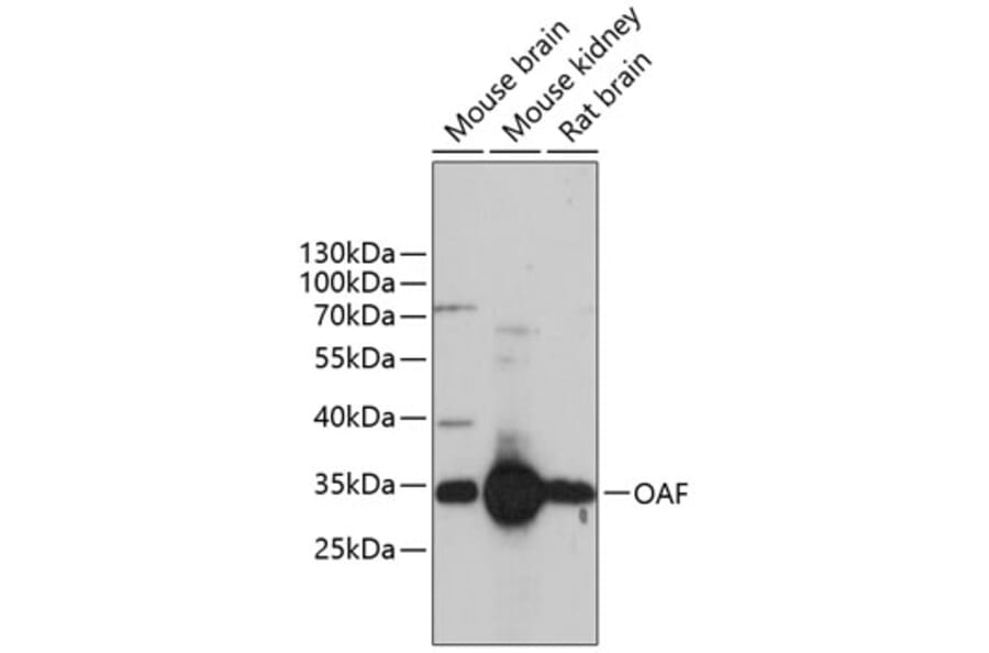 Western Blot - Anti-OAF Antibody (A89183) - Antibodies.com