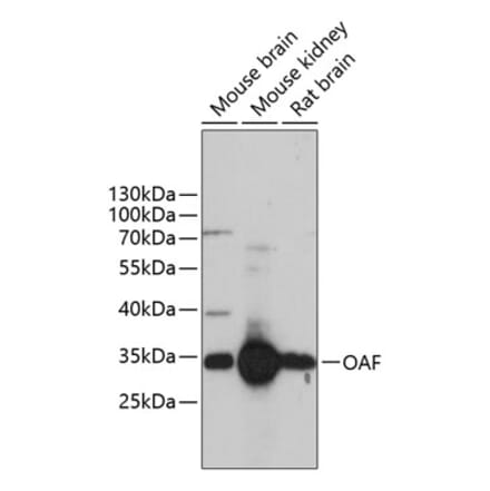 Western Blot - Anti-OAF Antibody (A89183) - Antibodies.com