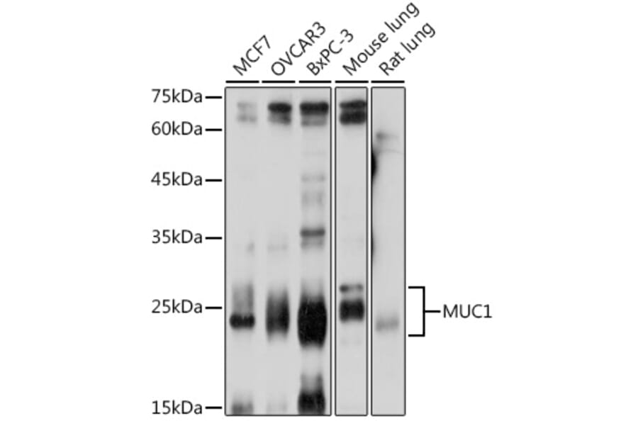 Western Blot - Anti-MUC1 Antibody (A89184) - Antibodies.com