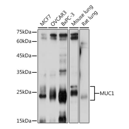 Western Blot - Anti-MUC1 Antibody (A89184) - Antibodies.com