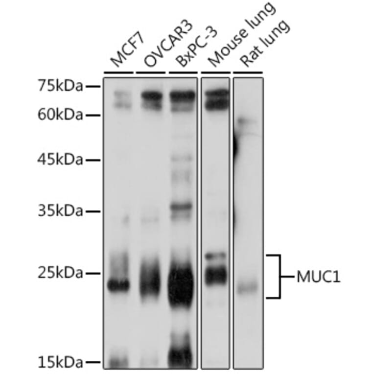 Western Blot - Anti-MUC1 Antibody (A89184) - Antibodies.com