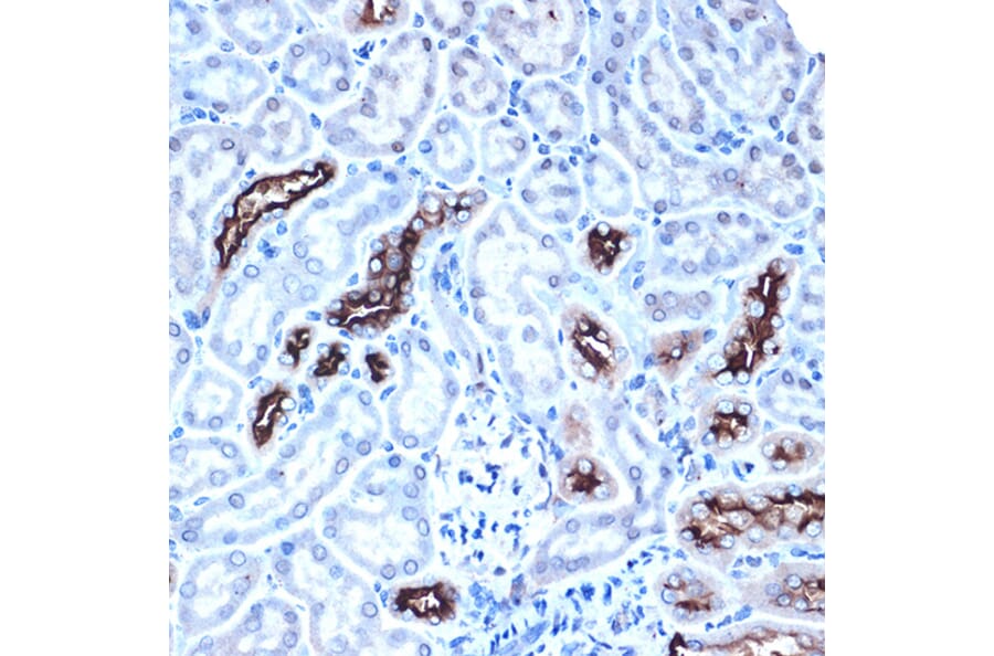 Immunohistochemistry - Anti-MUC1 Antibody (A89184) - Antibodies.com