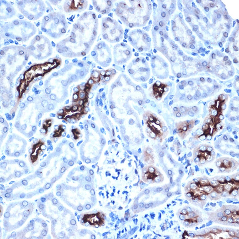 Immunohistochemistry - Anti-MUC1 Antibody (A89184) - Antibodies.com