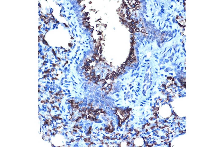 Immunohistochemistry - Anti-MUC1 Antibody (A89184) - Antibodies.com