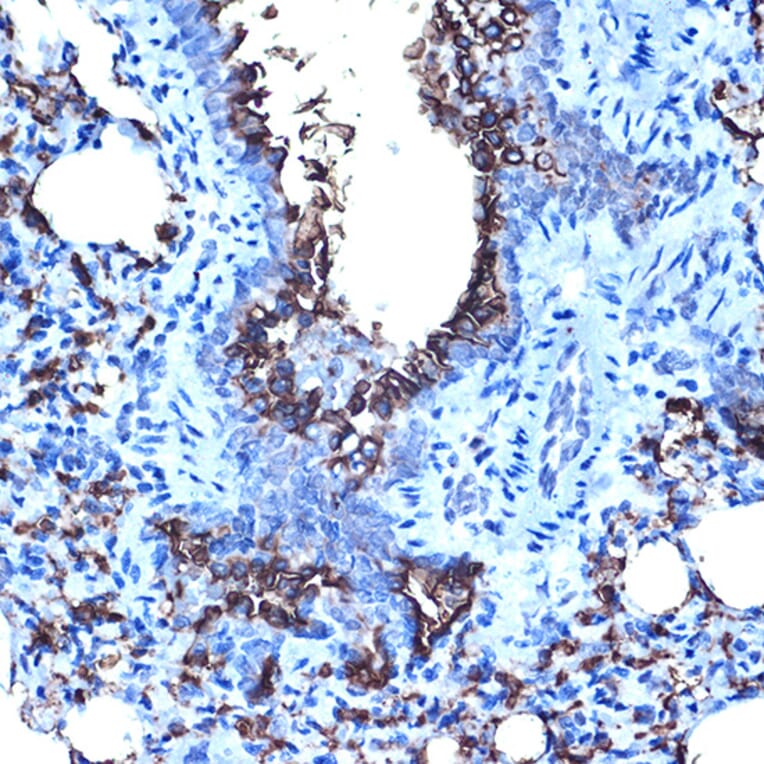 Immunohistochemistry - Anti-MUC1 Antibody (A89184) - Antibodies.com