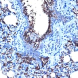 Immunohistochemistry - Anti-MUC1 Antibody (A89184) - Antibodies.com