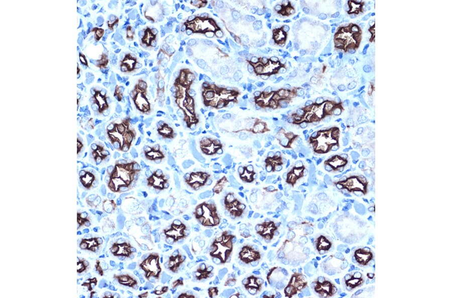 Immunohistochemistry - Anti-MUC1 Antibody (A89184) - Antibodies.com