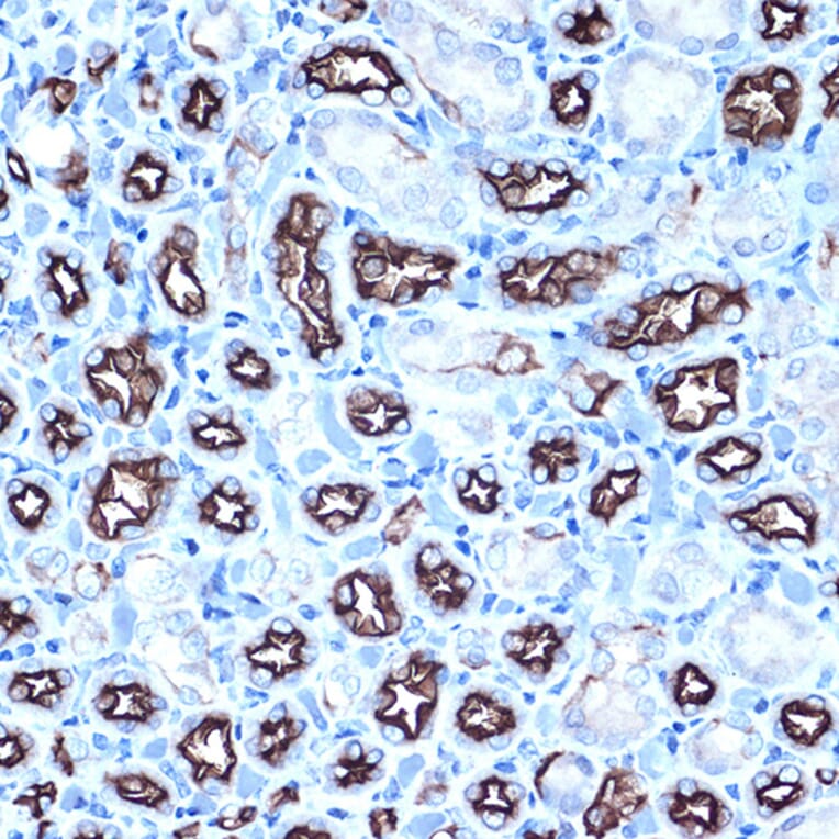 Immunohistochemistry - Anti-MUC1 Antibody (A89184) - Antibodies.com
